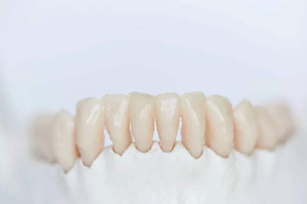 Vista Cerca Los Dientes Humanos Artificiales Modelo Hueso Mandíbula — Foto de Stock