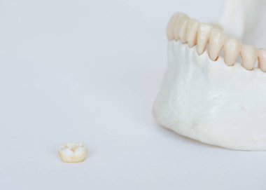 Molar diş ve yapay insan çene kemik model beyaz arka plan üzerinde