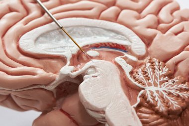 Parkinson için subtalamik çekirdekte beyin kaydı kavramı 