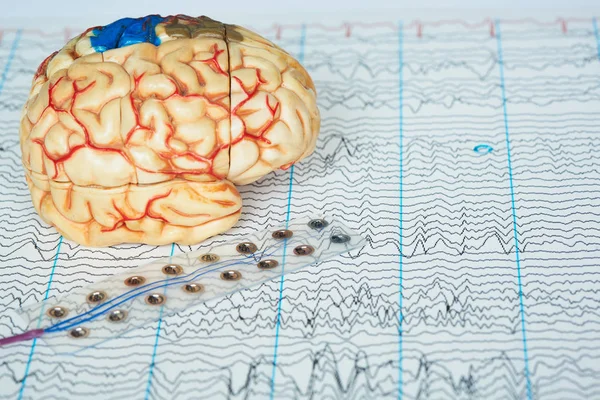 Lidský mozkový model a elektroda nahrávací mozkové vlny na backgro — Stock fotografie