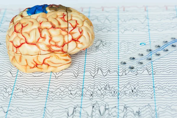 Modelo de cerebro humano y electrodo subdural que registra ondas cerebrales o — Foto de Stock