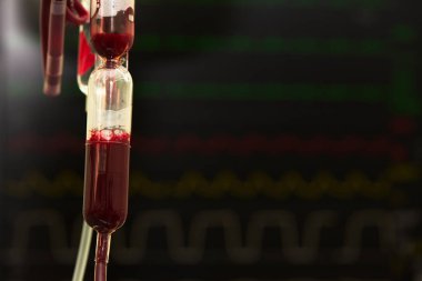 Ameliyathanede kan nakli için asılı kan torbası