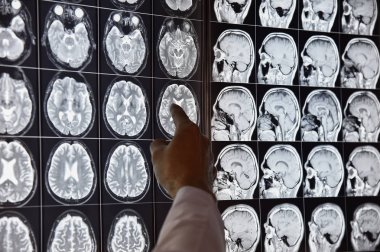 Doktor radiolopgy odada MRI beyin işaret