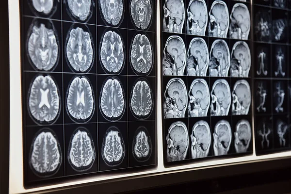 Photograph of normal magnetic resonance imaging