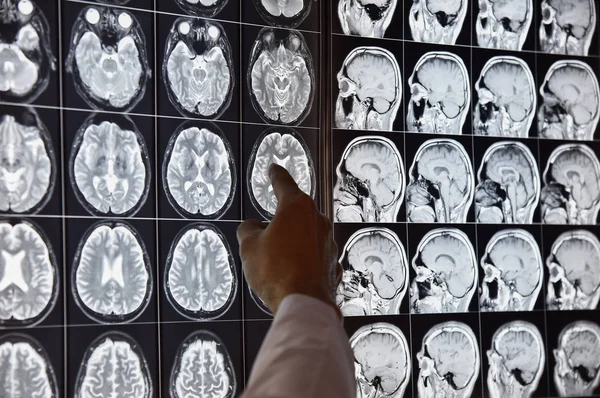 Doctor apuntando al cerebro por resonancia magnética en la sala de radiopsia — Foto de Stock