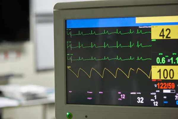 Monitoring graph displays of patient vital signs  in operating r