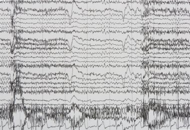 Imaging of electroencephalography recording of human clipart