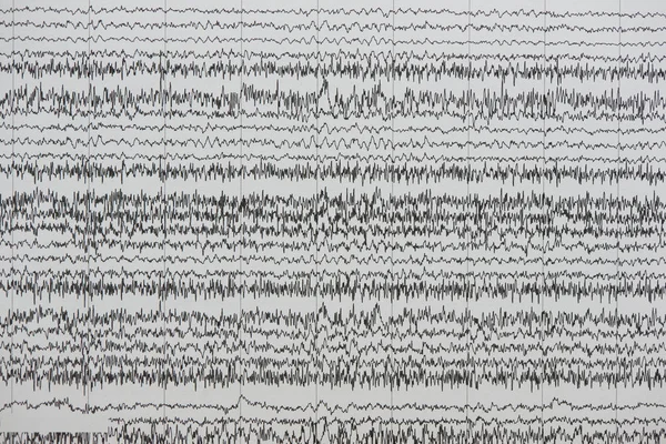 Background of brain waves on the paper
