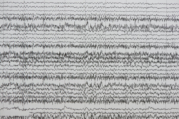 Фон мозговых волн на бумаге
 