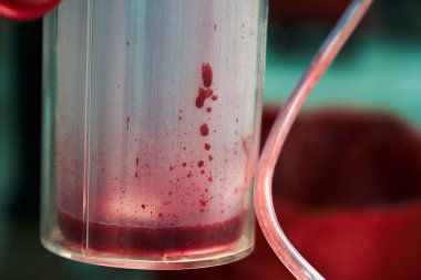 Cerrahi vaccum da cerrahi vaccum kan kaybı yakın çekim görünümü