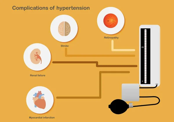 Complicaciones Hipertensión Que Afecta Los Órganos — Vector de stock