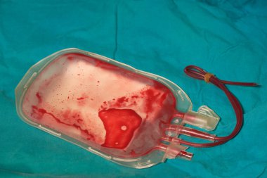 Ameliyat odasındaki yeşil kılıfta kan torbası üstüne kan.