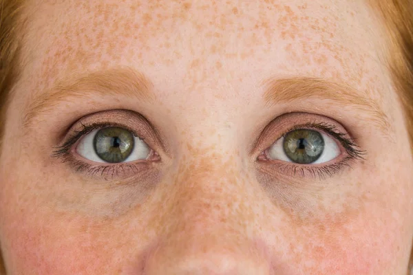 Primer Plano Las Pecas Cabeza Leída — Foto de Stock