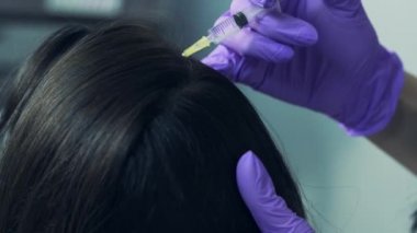 Uzun saçlı hasta kadın oturur ve Doktor kafasına saç büyümesi için enjekte eder. Şevval özçelik güzellik ilham saç için küçük şırınga ile baş iğneleyici mavi eldiven eller. Makro çekim.