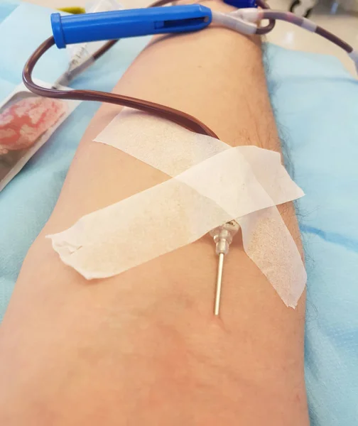 Brazo Donante Joven Durante Donación Sangre Hospital Con Aguja Insertada — Foto de Stock