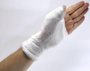 araba kazasından sonra kırık uzuv ile yaralı kişi