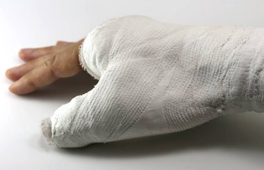 başparmak bir kaza nedeniyle kırılması sonra acil serviste adamın elini