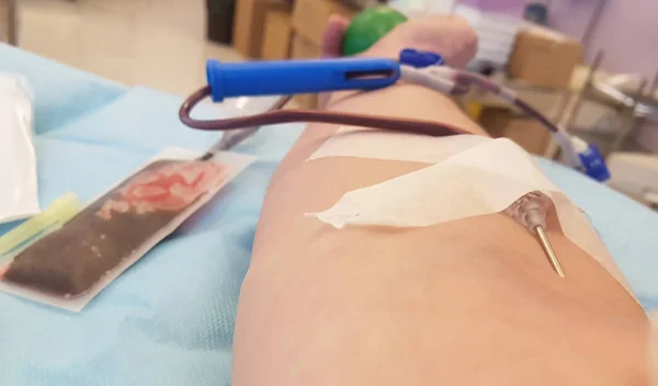 Brazo Donante Sangre Durante Plasmaféresis Centro Hospitalario Aguja Brazo — Foto de Stock