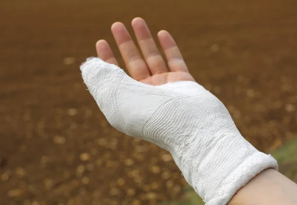 親指負傷後石膏でラップで手左官工事 — ストック写真