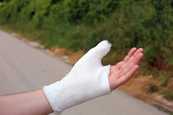 Рука Людини Оштукатуреним Великим Пальцем Через Домашню Аварію — стокове фото