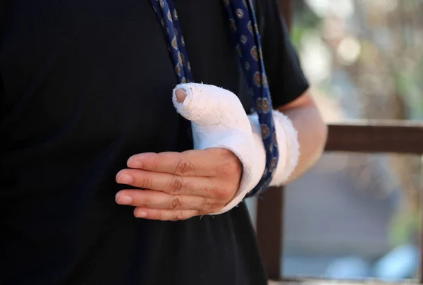 Young Man Arm His Neck Due Fractured Hand Cast — Stock Photo, Image