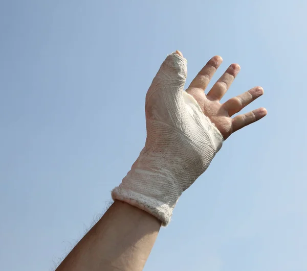 Homem Com Uma Mão Moldada Devido Acidente Doméstico Que Cuida — Fotografia de Stock