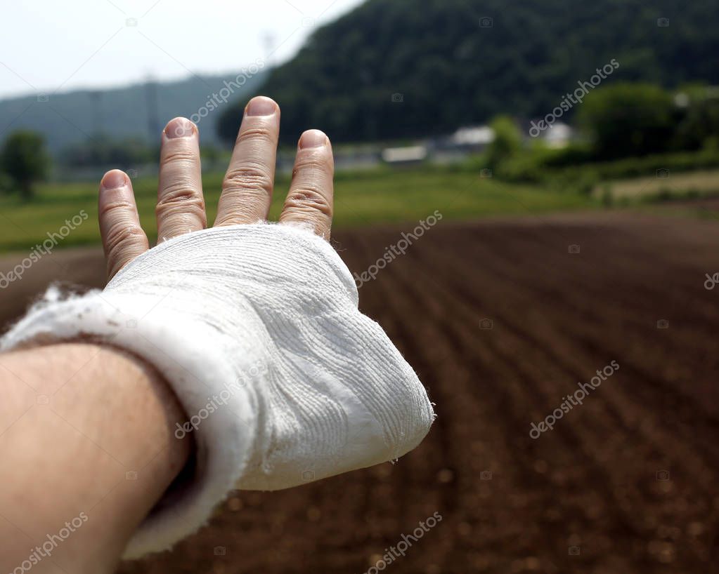 broken hand with white chalk outdoors in the countryside in a field