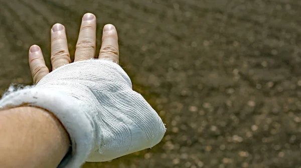 Hand Gepleisterd Als Gevolg Van Een Binnenlandse Ongeval Toont Velden — Stockfoto