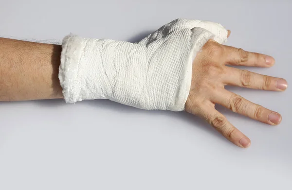 Fractured Hand Young Man White Background — Stock Photo, Image
