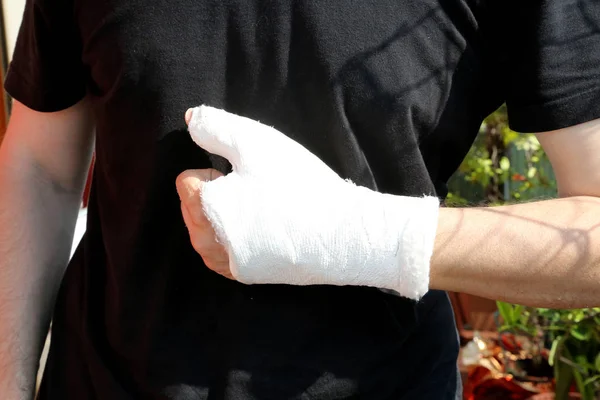 Gebroken Man Hand Met Orthopedische Gipsen Het Ziekenhuis Met Achtergrond — Stockfoto