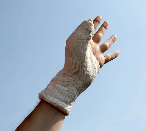 Розбита Рука Штукатурка Відлиті Лікарні Великим Пальцем Вгору Блідо Блакитним — стокове фото