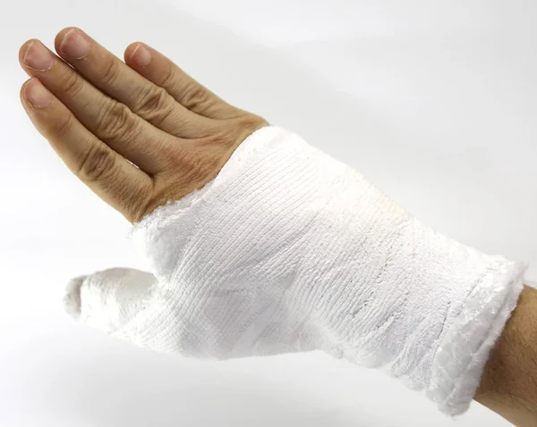 Hand Cast Fractured Car Accident — Stock Photo, Image