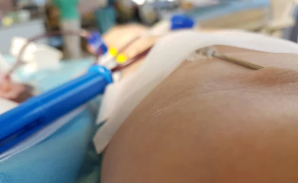 Voluntário durante a doação de sangue na cama de uma sala médica — Fotografia de Stock