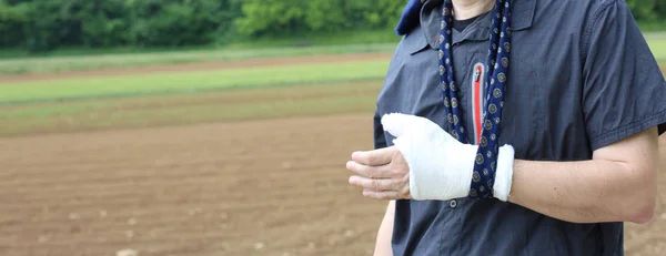 Gebroken hand van een man — Stockfoto