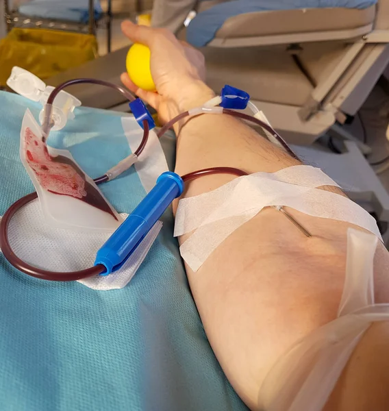 Arm van jonge vrijwilligers tijdens de donatie bloed in het bed van een — Stockfoto