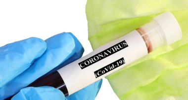 Doktor eldiveni ve Crown virüsü serolojik testi için kan örneği içeren tıbbi test tüpü ayrıca Covid-19