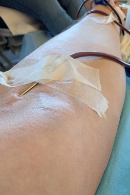 İğneyle yapılan kan bağışı sırasında genç adamın kolu.