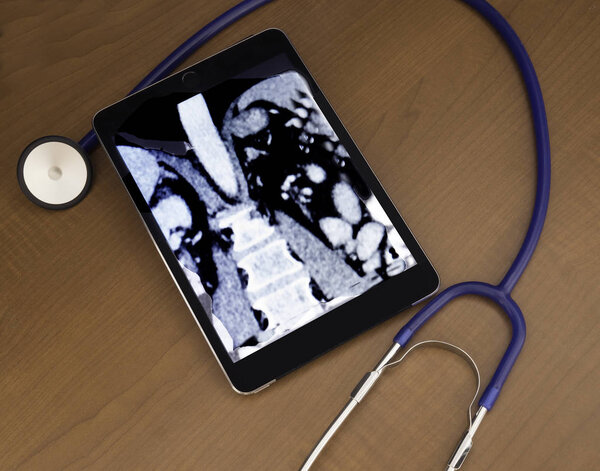 Ct scan to perform and evaluate a patient status 