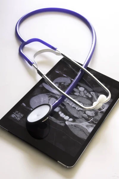 Ct scan to perform and evaluate a patient status and create — Stock Photo, Image