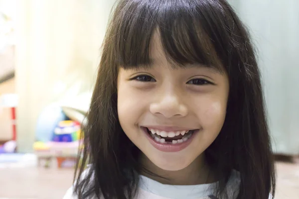 Μικρό Κορίτσι Χαμόγελο Λείπει Δόντια Του Γάλακτος — Φωτογραφία Αρχείου