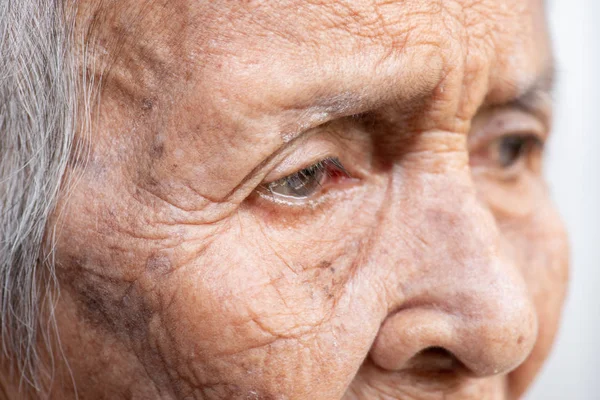 Старуха Падала Одиночестве Слабоумие Болезнь Альцгеймера — стоковое фото