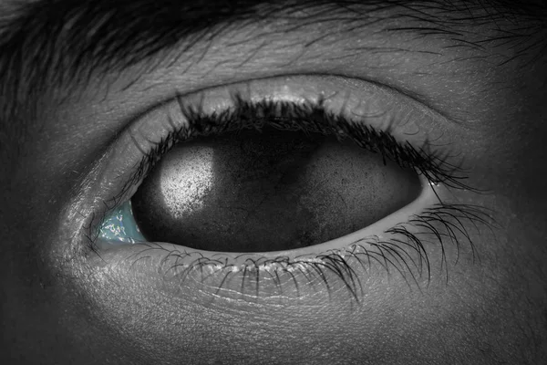 Surreal scary close-up of zombie eye with black metal eyeball. Macro. Halloween theme, pallid skin