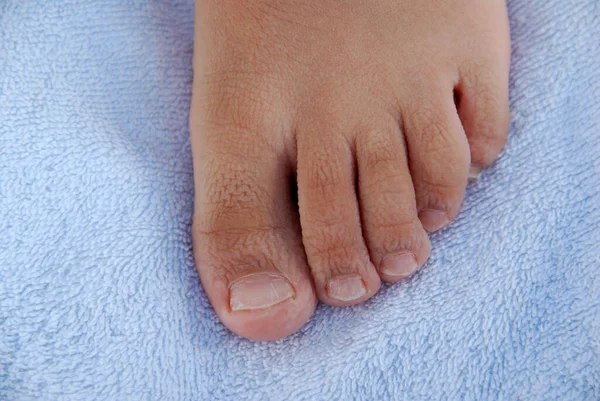 lose-up strongly soaked and wrinkled skin on the foot of a child after bathing against blue soft towel background