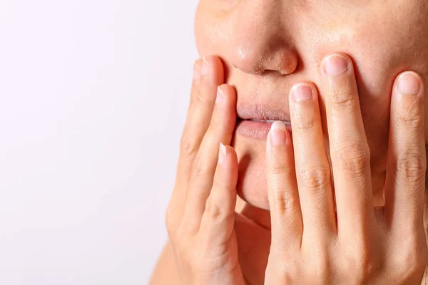 Donne Allergiche Hanno Eczema Naso Secco Labbra Sulla Stagione Invernale — Foto Stock
