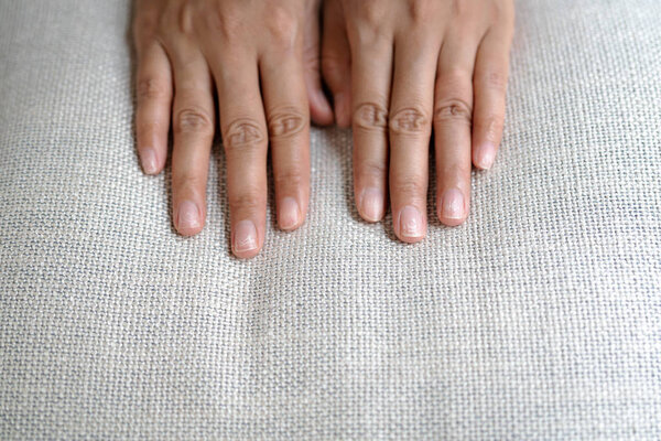 хрупкие поврежденные ногти после использования шеллака или гель-лака
