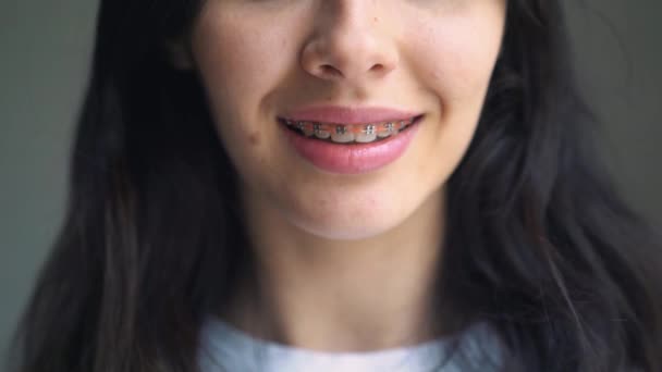 Młoda dziewczyna z szelkami na zęby można odchylić głowę i pojawia się w ramce. Młoda kobieta na tle białej ściany, uśmiechając się z szelkami — Wideo stockowe