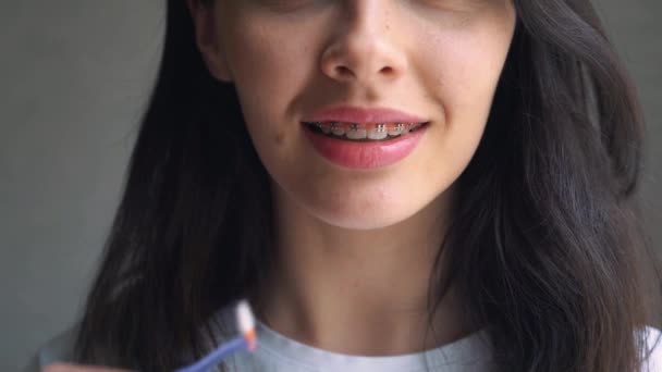 Närbild kvinnliga tänder med hängslen och mellanrumsborste för Dental hängslen hygien. Tandreglering. Framifrån. Flicka rengör hängslen — Stockvideo