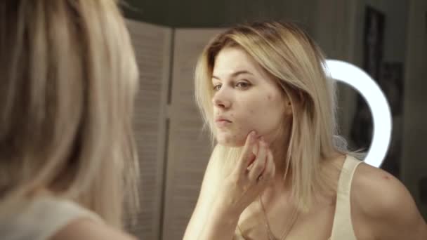 Portréja egy tinédzser a problémás bőrre, közelkép — Stock videók
