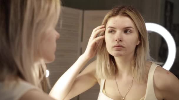 Portréja egy tinédzser a problémás bőrre, közelkép — Stock videók
