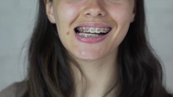 Chica joven con frenos en los dientes mirando a la cámara y sonriendo. De cerca. . — Vídeos de Stock